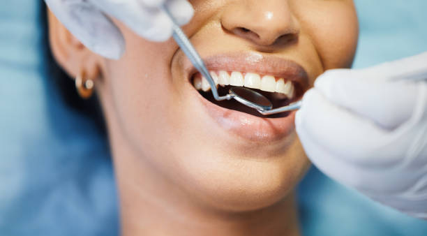 Best Emergency Dental Care for Trauma or Injury in District Heights, MD